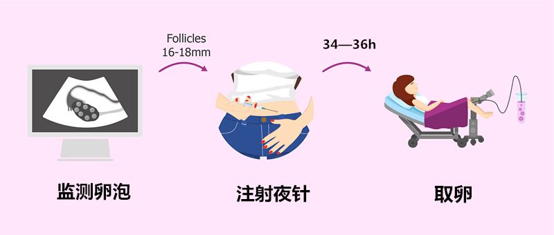 取卵后肚子大但不痛，原因解析与应对建议