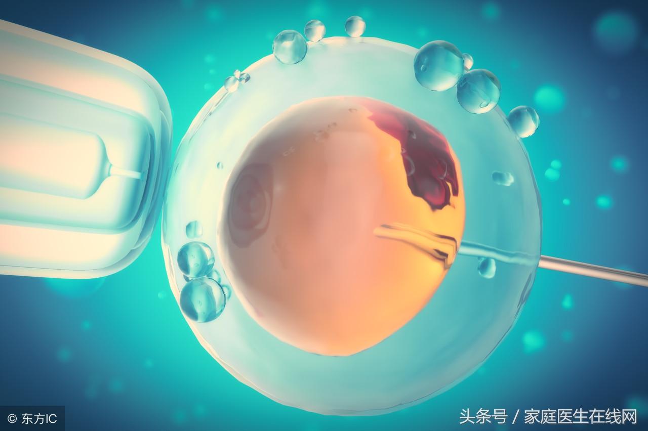 试管婴儿技术中的取卵过程及其持续时间解析
