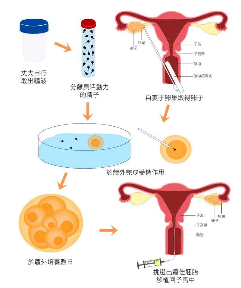 试管卵泡发育与取卵时机，卵泡大小对试管婴儿过程的影响