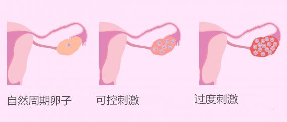 44岁取卵一枚，人生的转折点与挑战